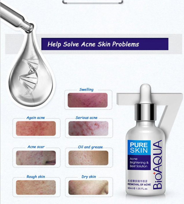 Bio Aqua Pure SKIN Acne Removal & Brightening Solution